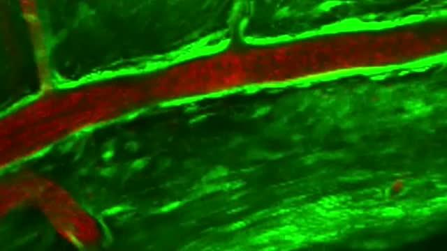 Brain Organoids as Models for Neurological Disorders