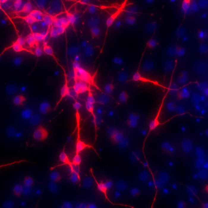 High fructose during pregnancy impairs stem cell function in the fetal brain