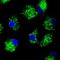 Macrophages Harness Zinc to Fight Infection (1 of 2)