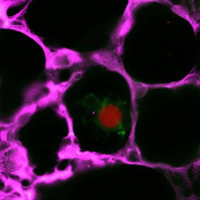 Two-Phased Clot Clearance Method May Hinder and Help (2 of 7)