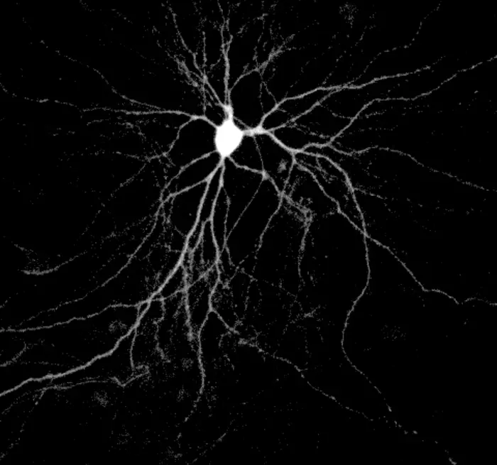 Neuron in a dish