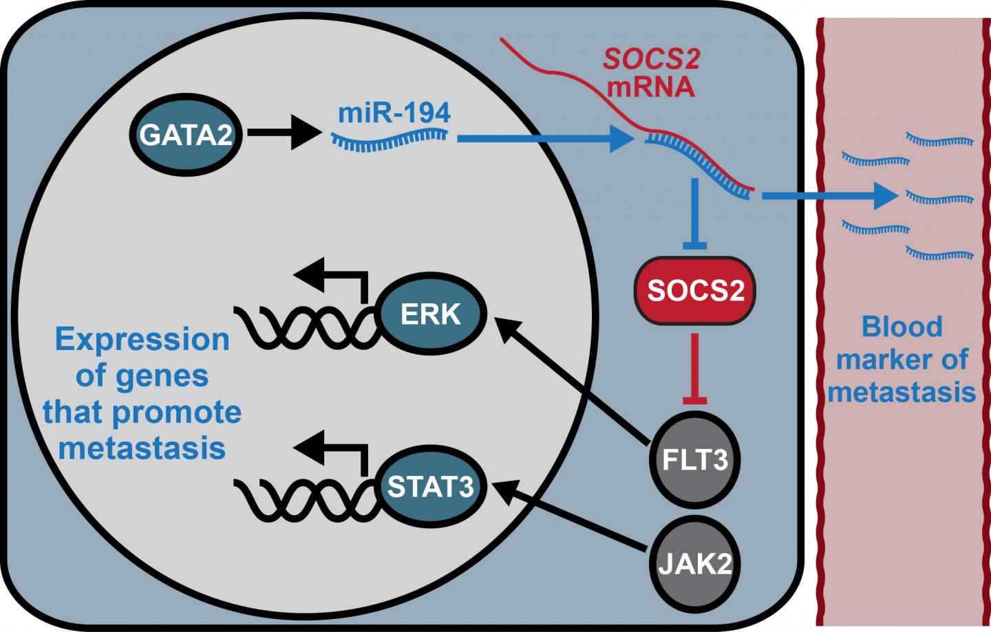 New Pathway Regulating Spread of Prostate Cancer