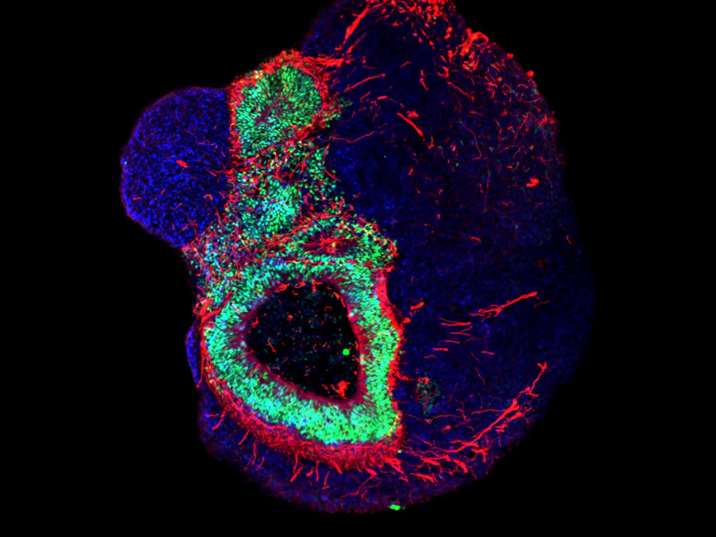 Brain Organoids