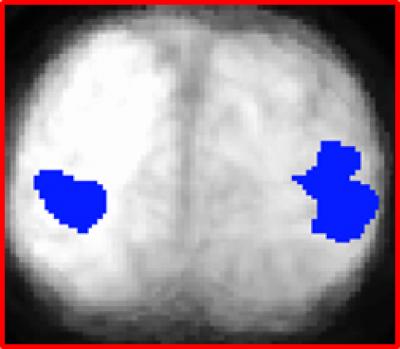 Visual Cortex Response to Emotional Faces