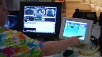 Bariatric Surgery in Teens May Help Treat Cardiovascular Risks