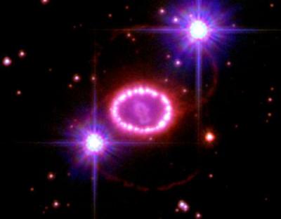 String of Pearls/Supernova 1987A