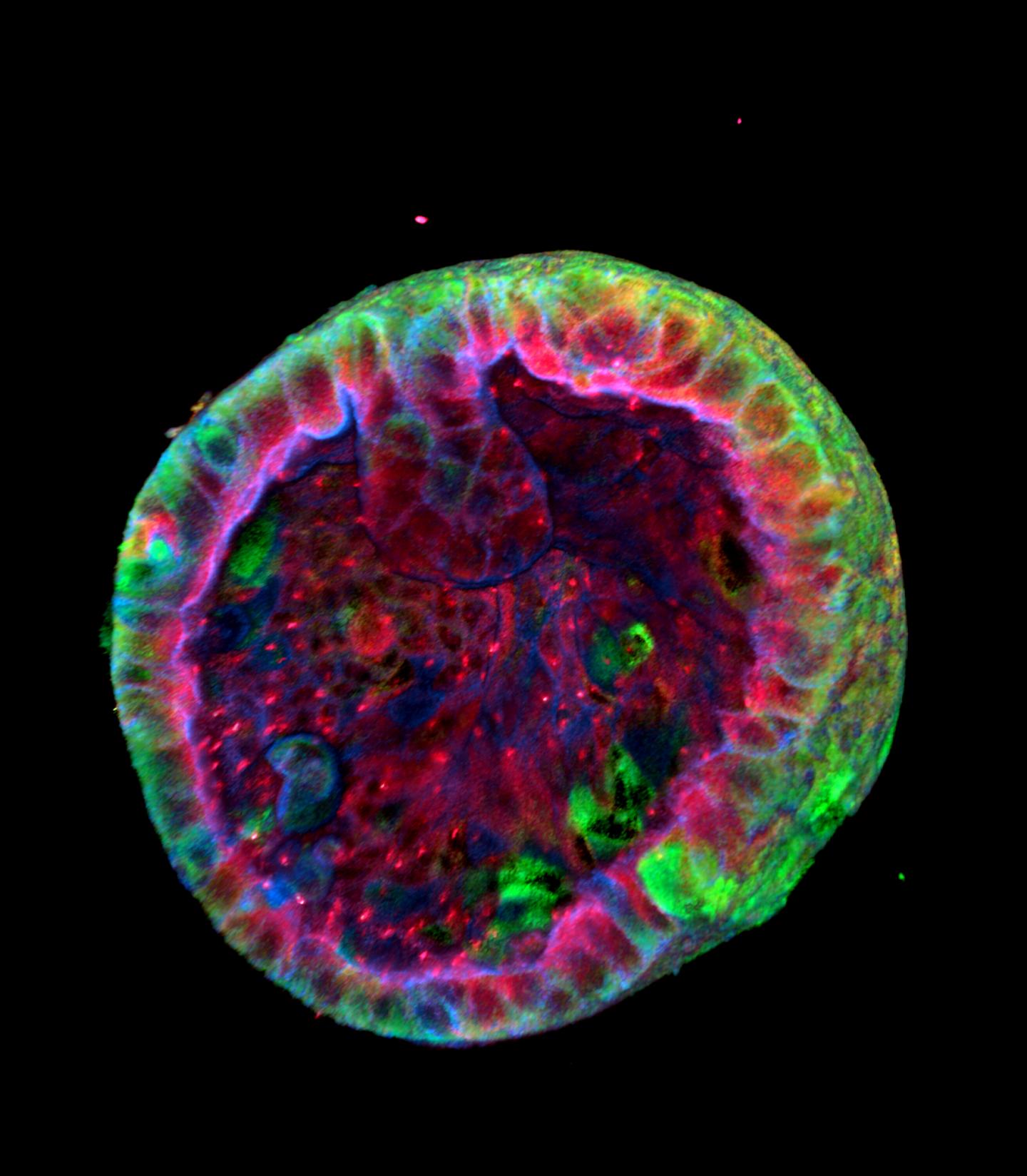 A Kidney Organoid (1 of 2)