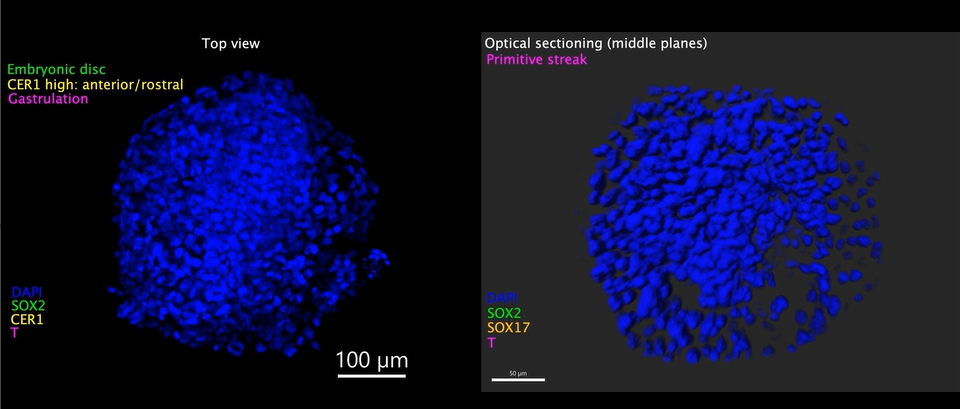 Peri-gastruloid with an embryonic disc-like structure CREDIT Cell Liu et al.