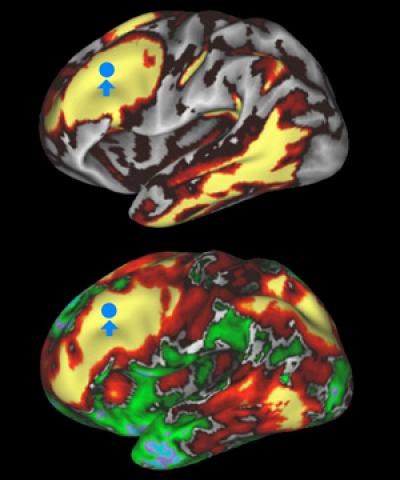 Connectome Brain Scans