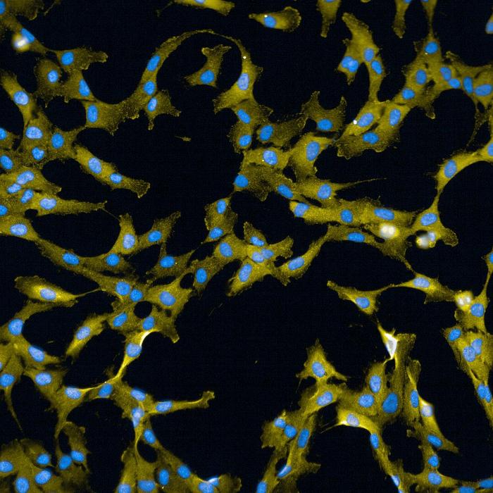 Human epithelial cells labelled for a Wee1 target (phosphorylated CDK; in yellow) and DNA (in blue)