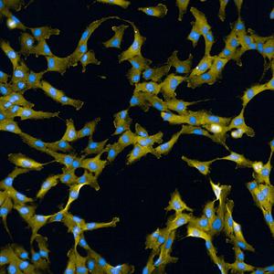 Human epithelial cells labelled for a Wee1 target (phosphorylated CDK; in yellow) and DNA (in blue)