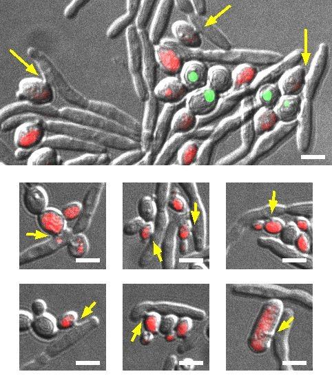 Exploiting Parasitic Yeast to Kill Yeast Pathogens