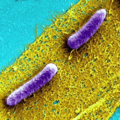 Biofilms