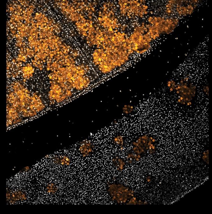 Bar-Ilan University Study Uncovers the Origin of Sleep in Jellyfish and Sea Anemones