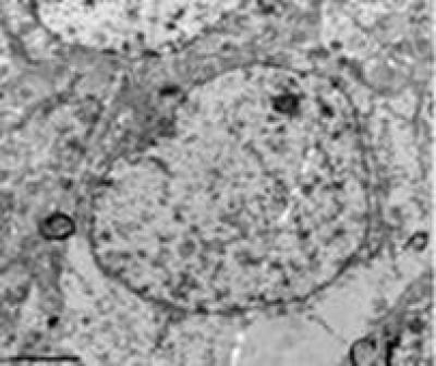 Cortical Neurons in Rats