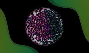 Confocal section of an embryo where in one half