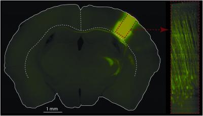 Brain and Nerve Cells