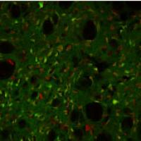 Neurons