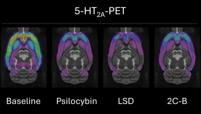 5-HT2A-PET
