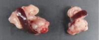 Halting Tumor Growth