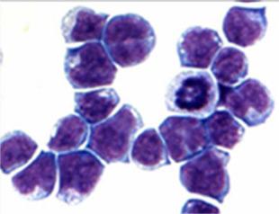 More Paths to Leukemia