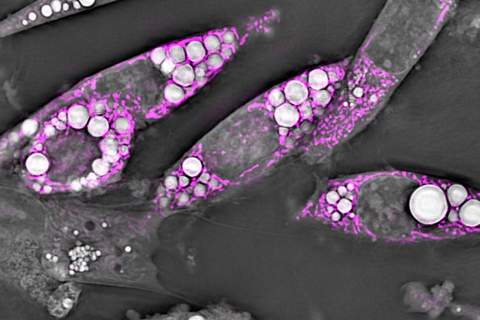 Brown fat cells