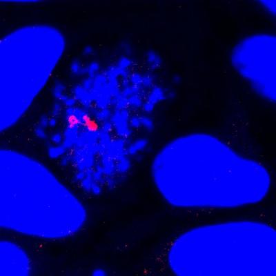 Antibiotics: A Natural Vaccine for Malaria? (4 of 5)