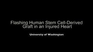 Flashing Heart Muscle Cells