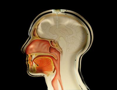 Hydrocephalus: Sensors Monitor Cerebral Pressure