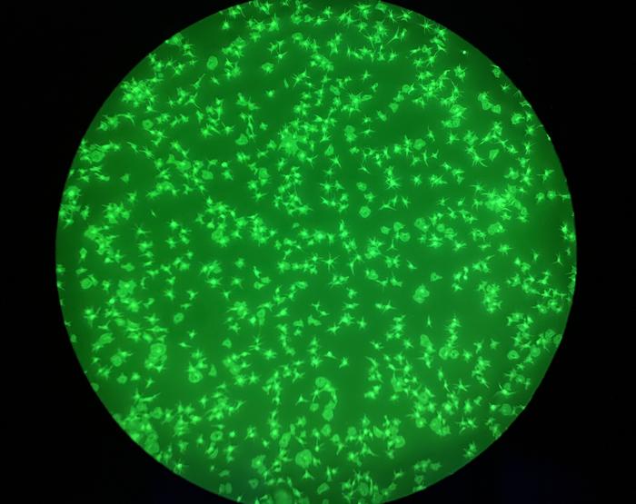 Platelet microscopy