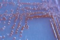 <i>Serratia marcescens</i>