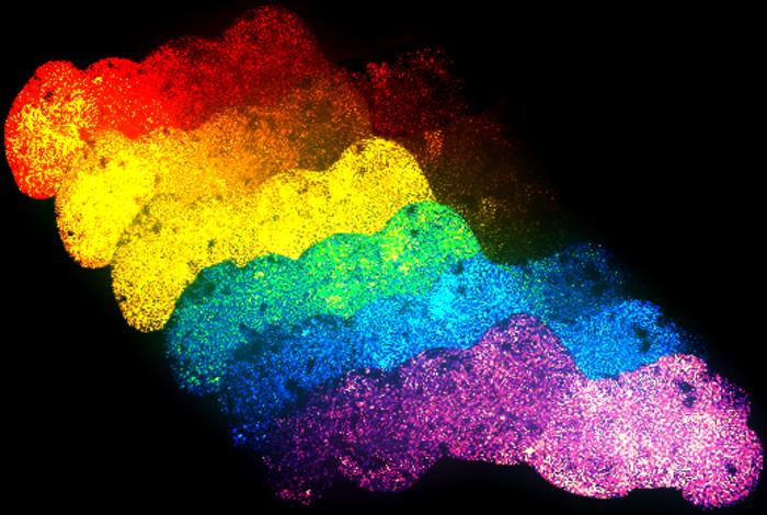 Pseudo-colored collage of fused human neural organoids (Asteroid Belt) at different timepoints, displaying long-distance propagation of neural network activity.