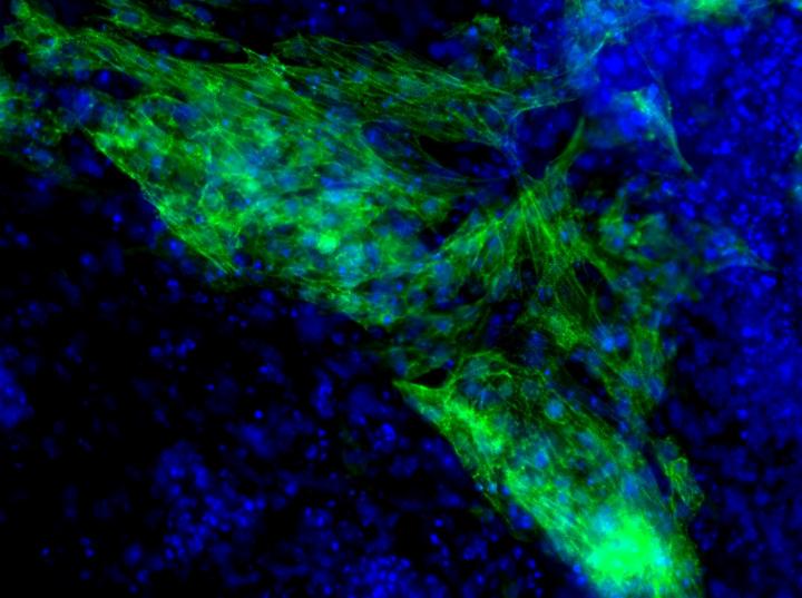 MicroRNA-Induced Heart Muscle Cell Formation