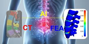 AI Spine Modeling