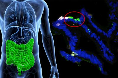 It May Take Guts to Cure Diabetes