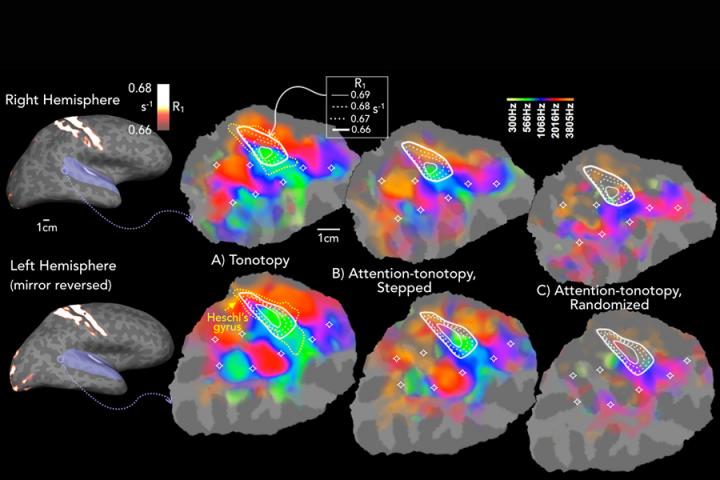 New Noninvasive Approach Reveals Brain Mechanisms of Auditory Attention