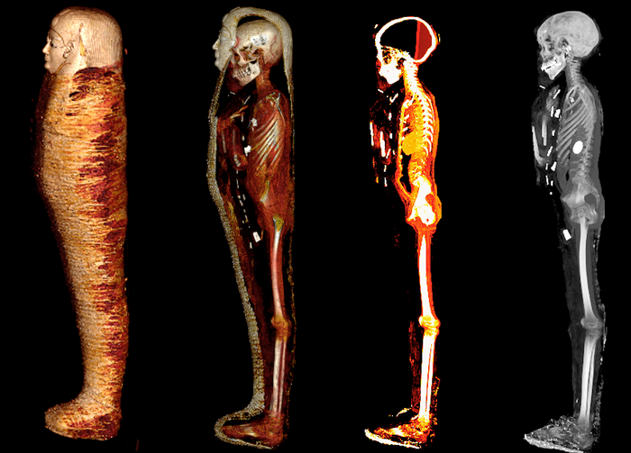 'Golden boy' mummy