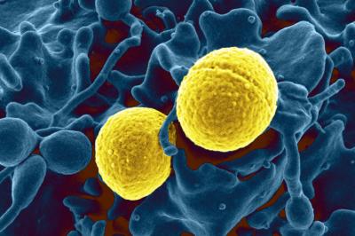 USA300 Strain of <i>S. aureus</i>