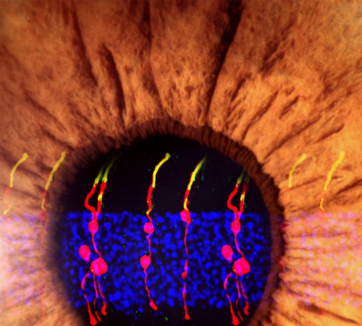 Müller Glia-Derived Rod Photoreceptors
