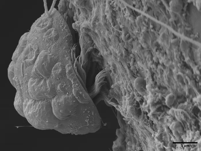 A protist parasite living on Tanystylum kiixin