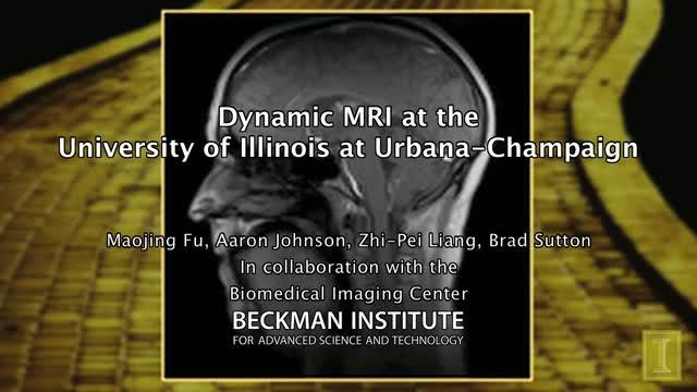 New Super-Fast MRI Technique: Singing 'If I Only Had a Brain'