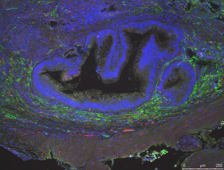 Tissue-Engineered Colon