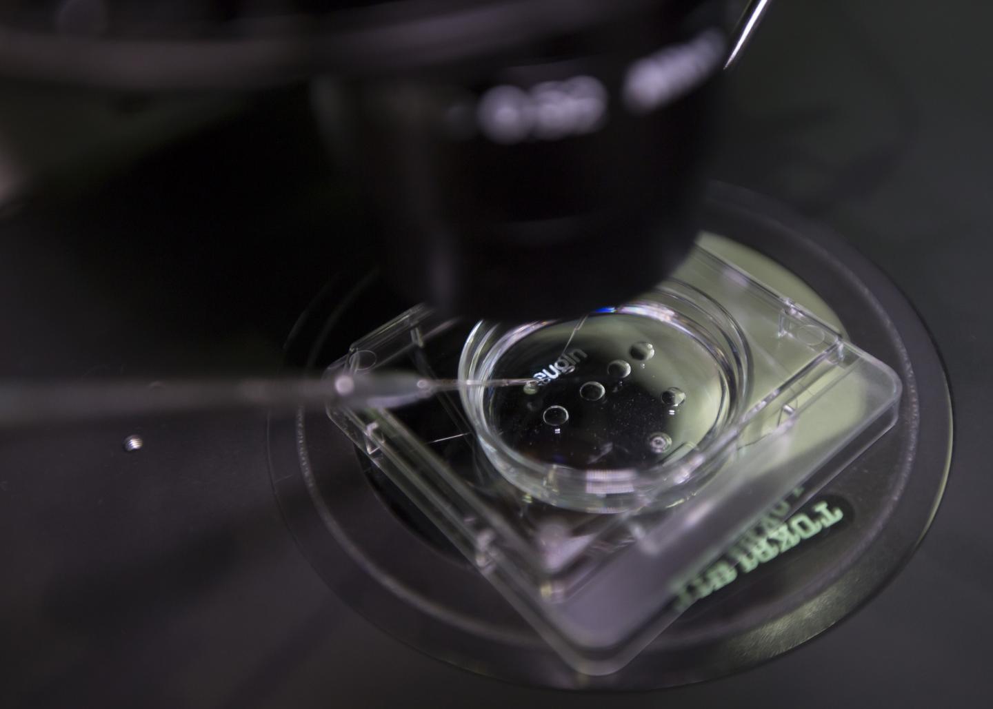 Human Sperm Analysis