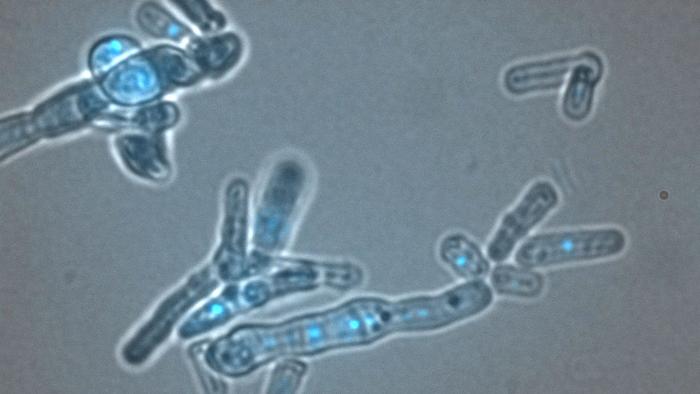 dcr1 rnh1 rnh201 triple mutant