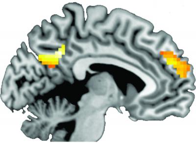 Brain