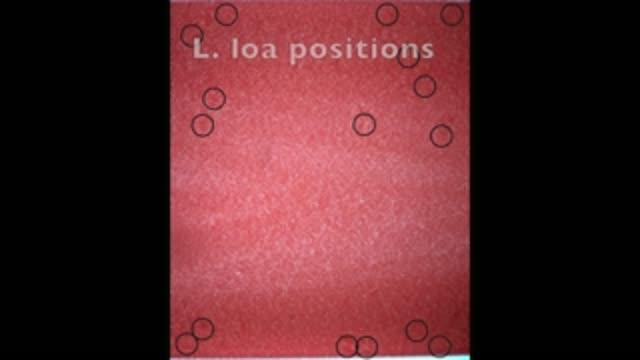 CellScope Loa Processing