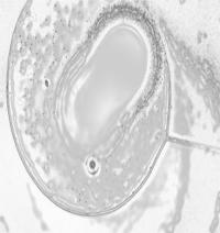 Extracting RNA From a Single Cell