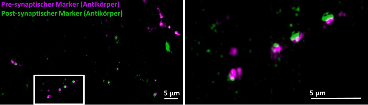 Fluorescent Synapses