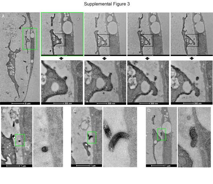 Appendix B