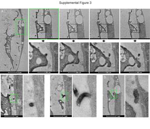 Appendix B